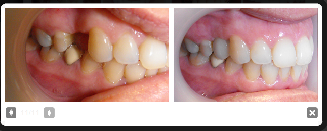 Lakes Dental Centre | dentist | 42 Berrigan Dr, South Lake WA 6164, Australia | 0894179779 OR +61 8 9417 9779