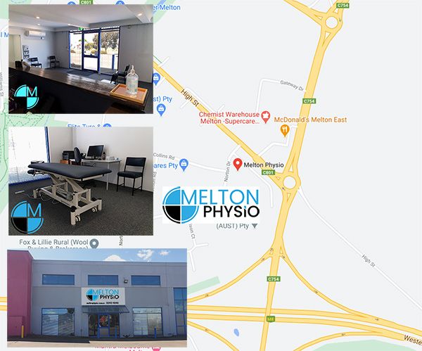 Melton Physio | physiotherapist | 1/93-95 High St, Melton VIC 3337, Australia | 0397434848 OR +61 3 9743 4848