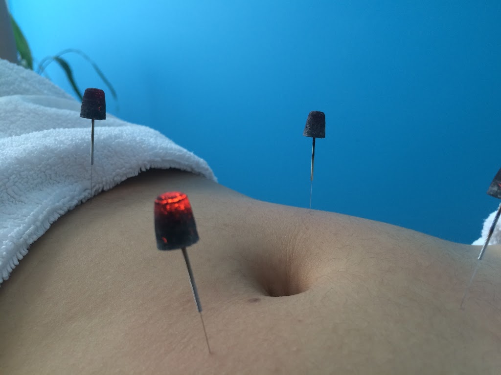 To the Point Health - Hazelbrook | 34 Luchetti Ave, Hazelbrook NSW 2779, Australia | Phone: (02) 4758 9275