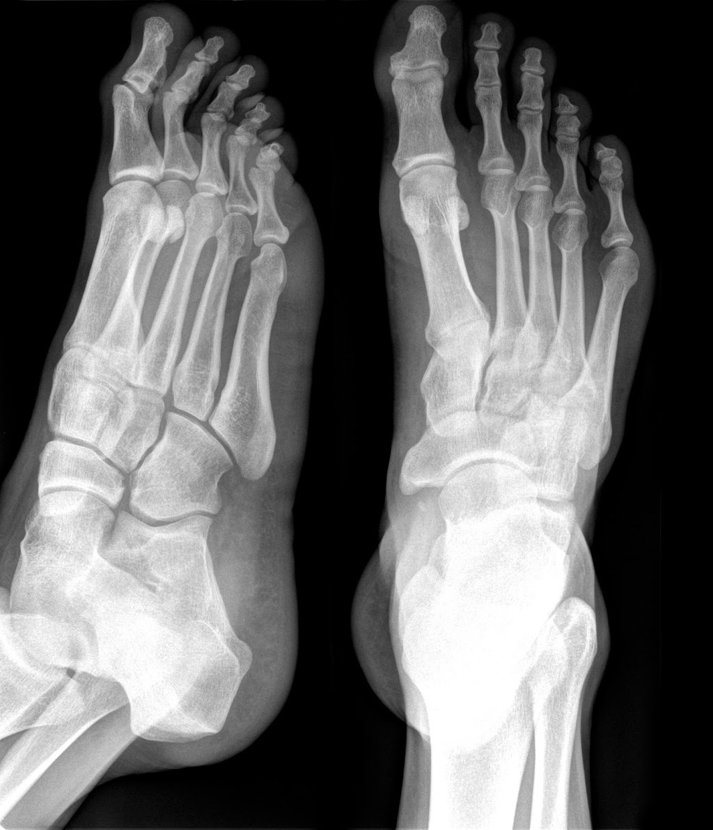 Think Feet Podiatry | doctor | 13/9 Scott St, East Toowoomba QLD 4350, Australia | 0746599678 OR +61 7 4659 9678