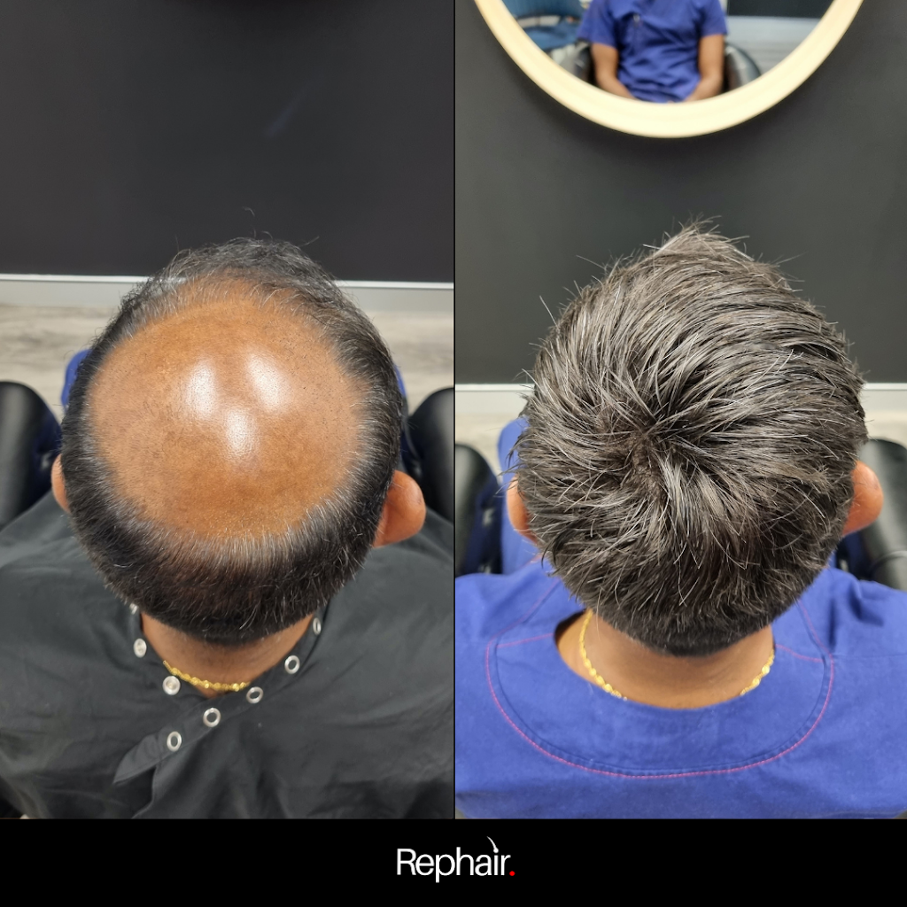 Rephair | 23/58 Riverwalk Ave, Robina QLD 4226, Australia | Phone: 0437 778 852