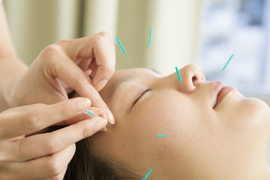 Healing with Acupuncture | health | 90 Mona Vale Rd, Warriewood NSW 2102, Australia | 0423362729 OR +61 423 362 729