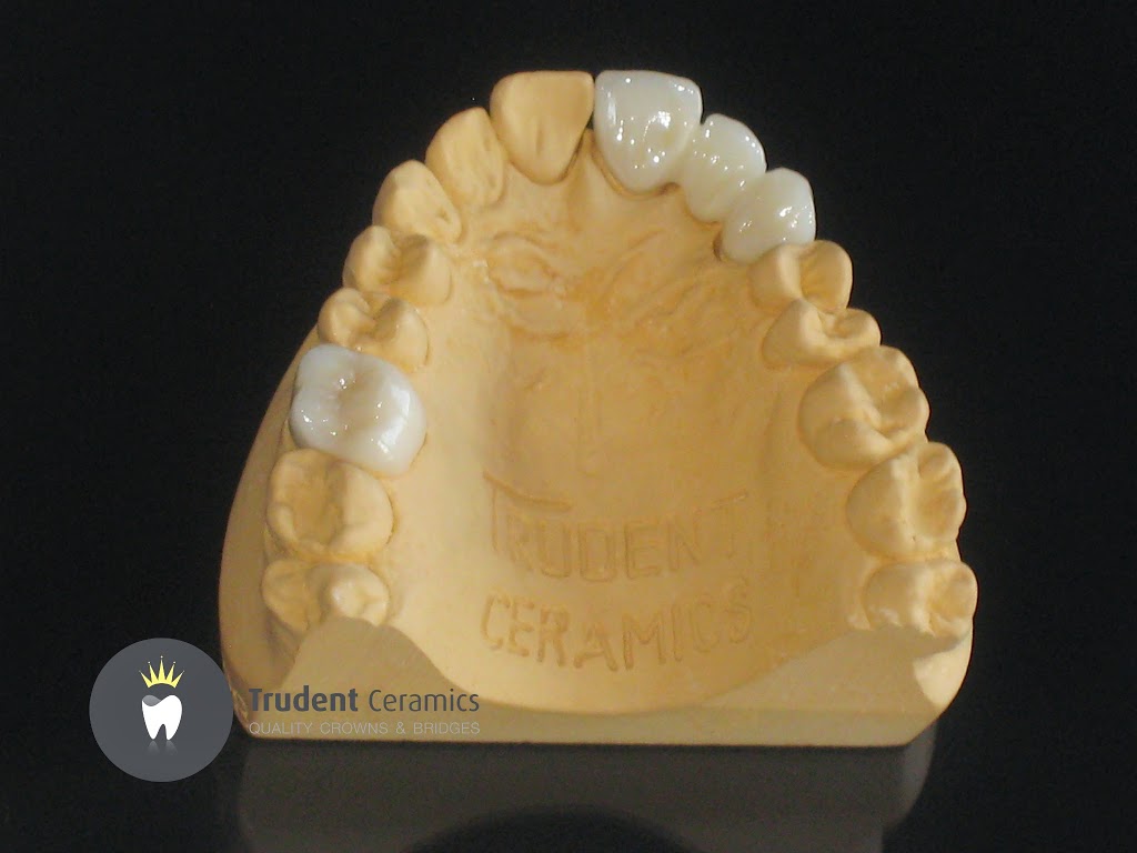 Trudent Ceramics | Unit 2/33 Mcclares Rd, Vermont VIC 3133, Australia | Phone: (03) 9893 3584