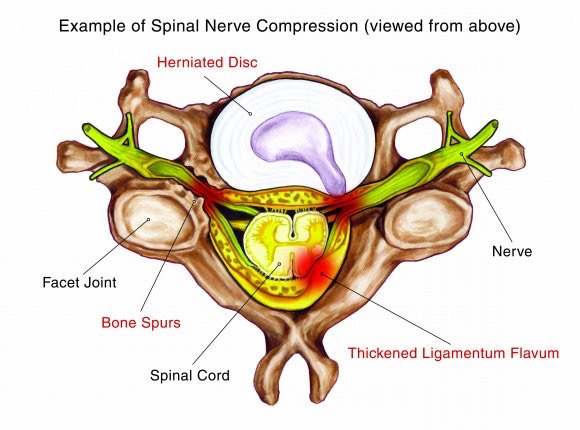 Dr Greg Finch | Sunshine Coast Spine & Orthopaedics | doctor | Nucelus Medical Suites, Suite 16a/23 Elsa Wilson Dr, Buderim QLD 4556, Australia | 0754447579 OR +61 7 5444 7579