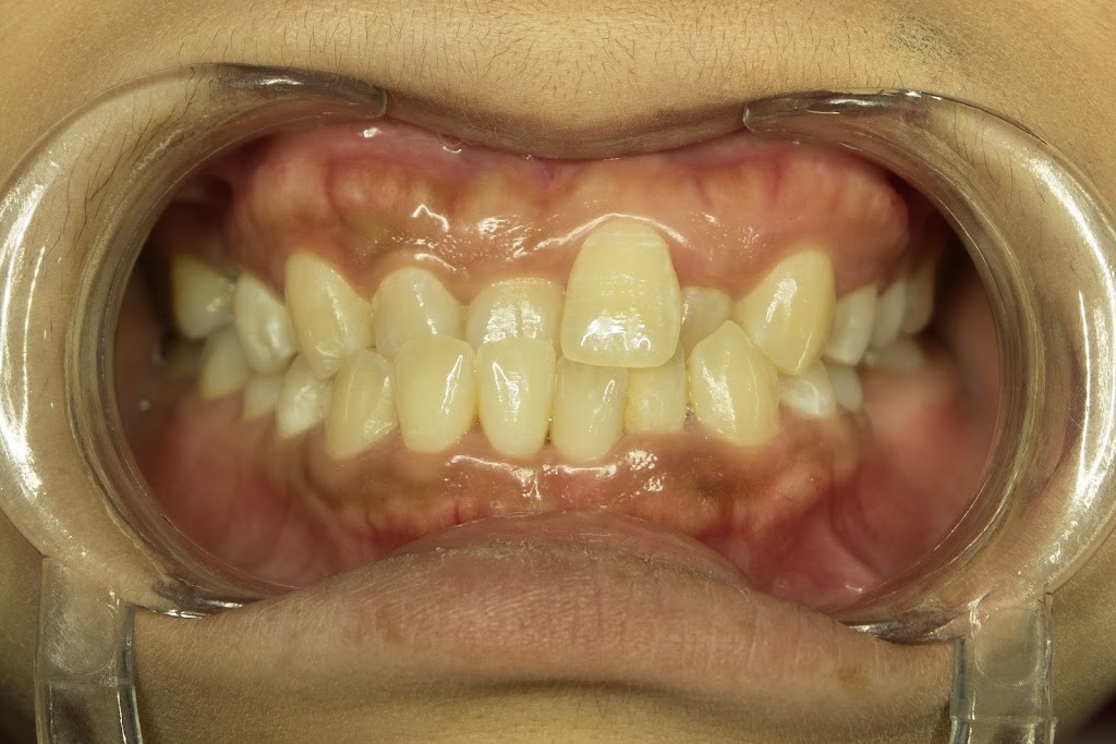 Love Your Smile Orthodontics | dentist | Suite 6 Level 1/100 Overton Rd, Williams Landing VIC 3027, Australia | 0383722005 OR +61 3 8372 2005