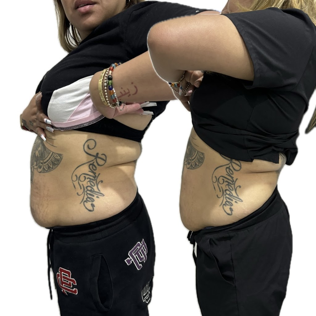 Slim Sculpt Studio | 27 Dilga Cres, Erskine Park NSW 2759, Australia | Phone: 0499 934 410