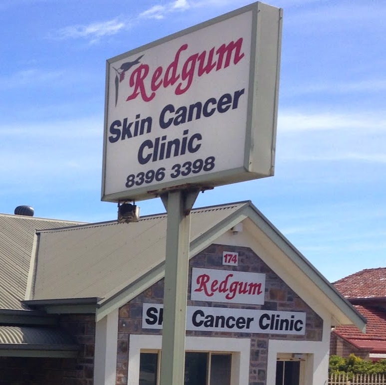 Redgum Skin Cancer Clinic | 174 Hancock Rd, Ridgehaven SA 5097, Australia | Phone: (08) 8396 3398