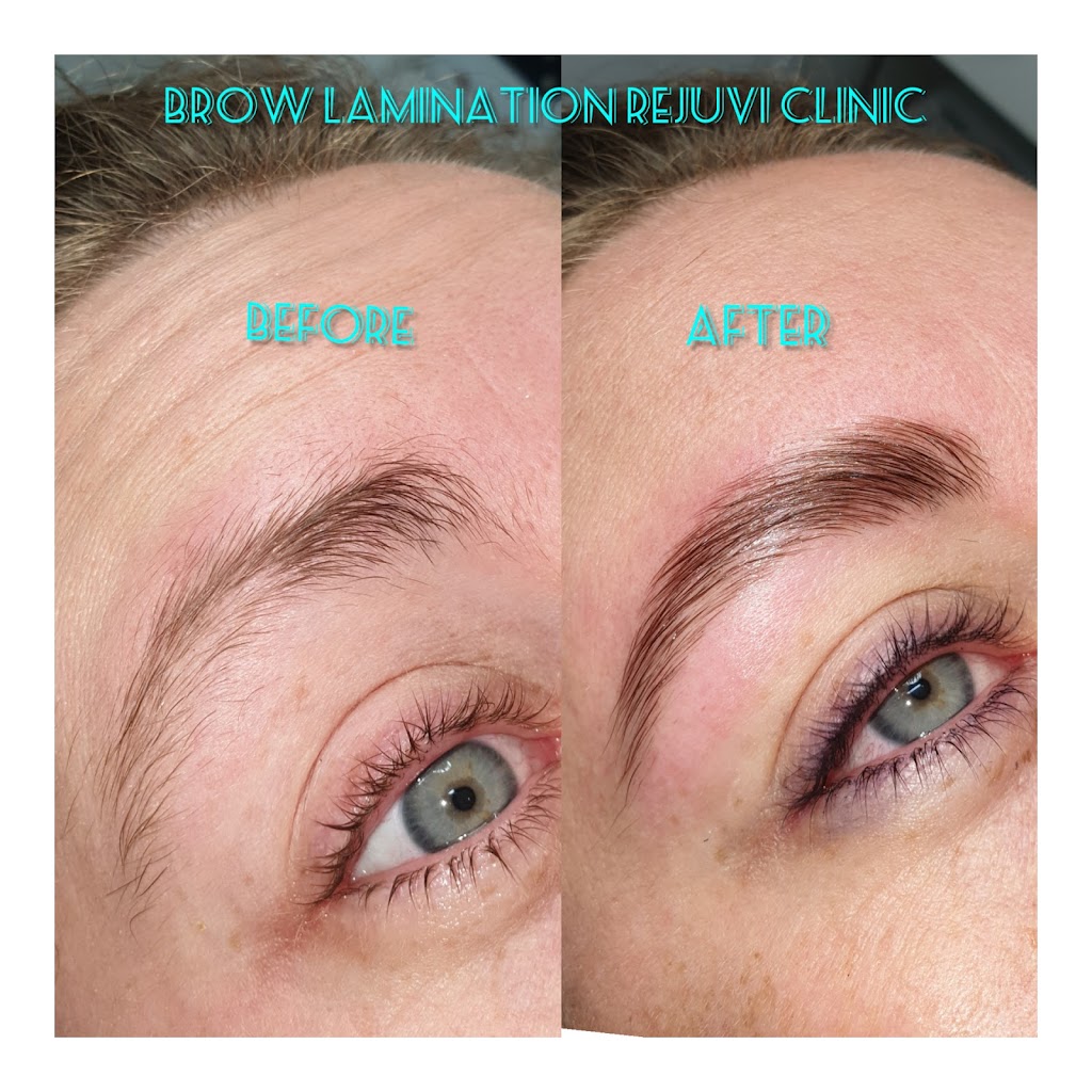 Rejuvi Results Skin Clinic | BY APPOINTMENT ONLY, 34 Dovercourt Rd, Toowong QLD 4066, Australia | Phone: 0403 506 642
