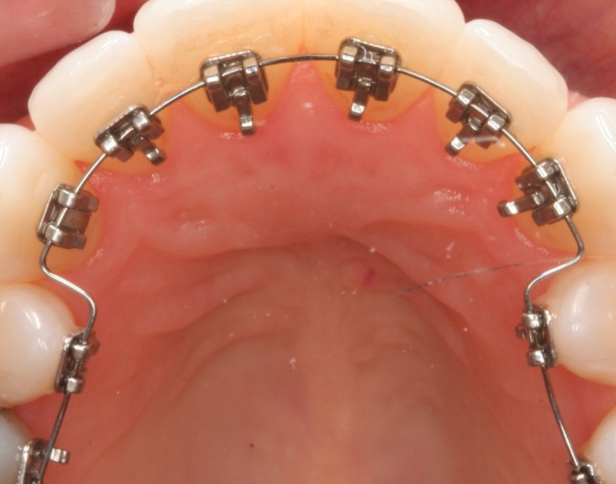 A Plus Dental Surgery | dentist | 385 Canterbury Rd, Forest Hill VIC 3131, Australia | 0398741309 OR +61 3 9874 1309