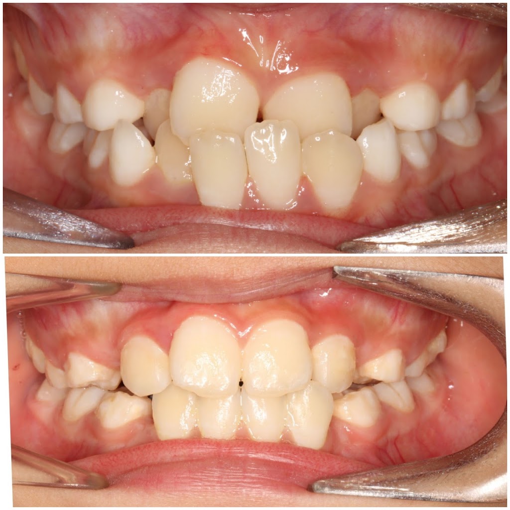 Braces N Faces Orthodontics | dentist | 255 Pakington St, Geelong VIC 3220, Australia | 0352216677 OR +61 3 5221 6677