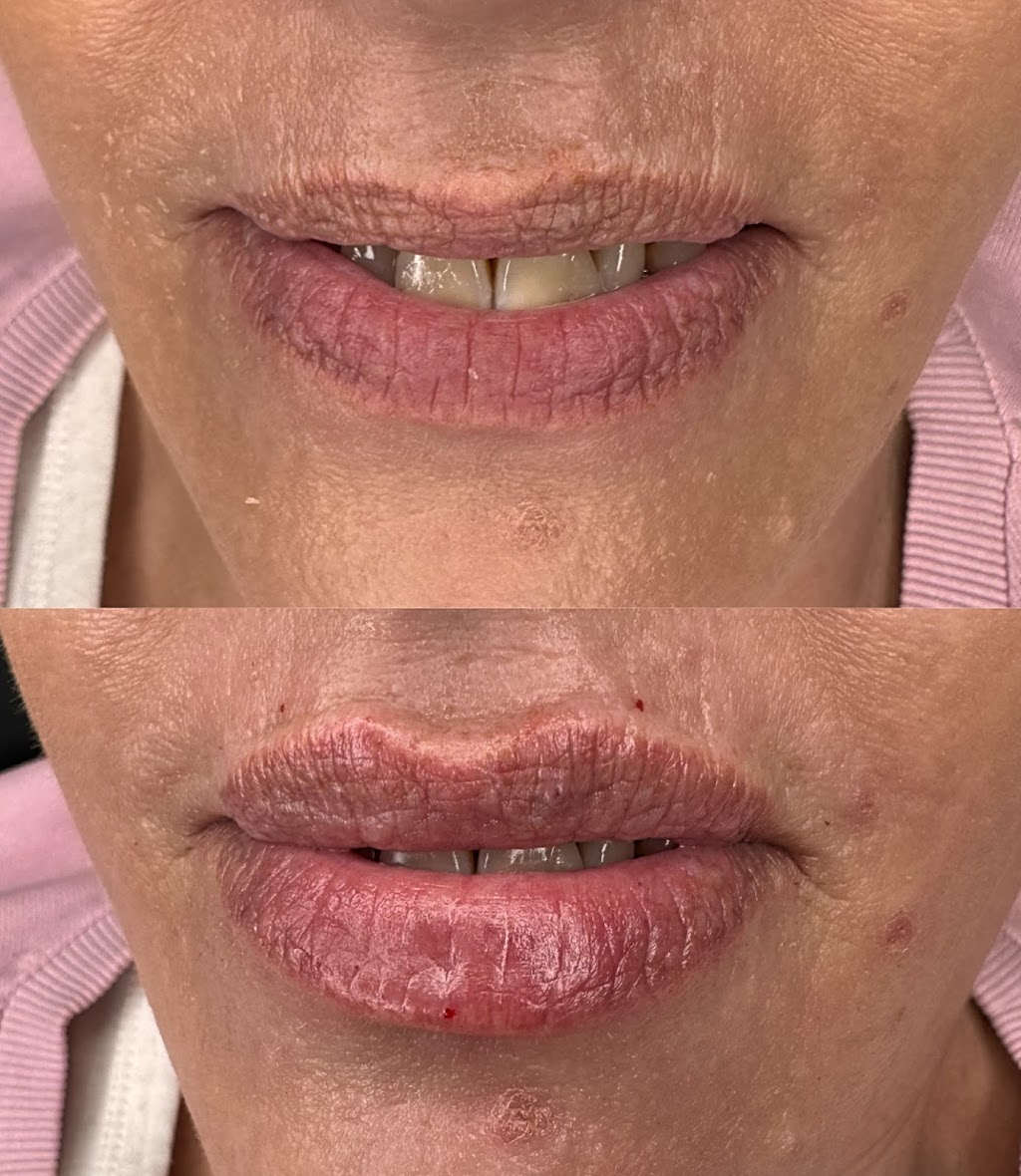 LULA AESTHETICS | 13 Harold St, Wendouree VIC 3355, Australia | Phone: 0411 667 116