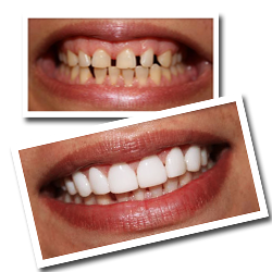Glamsmile - Dr Cal | dentist | Cnr Kenthurst Road & Maple Street, Round Corner Dural NSW 2158, Australia | 1300452676 OR +61 1300 452 676