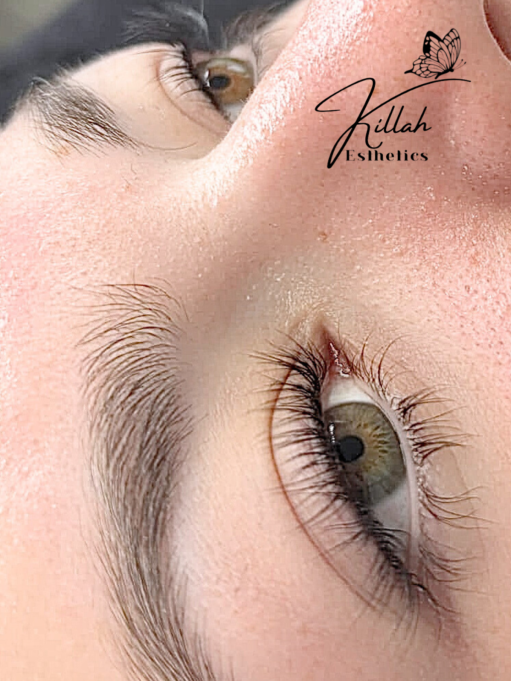 KillahEsthetics | 34 Wandewoi Ave, San Remo NSW 2262, Australia | Phone: 0422 214 280