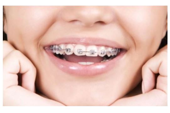 Tony Weir Orthodontics - Invisalign & Braces Orthodontists Brisb | dentist | 667 Oxley Rd, Corinda QLD 4075, Australia | 0732781492 OR +61 7 3278 1492