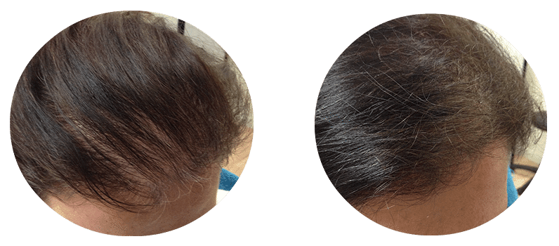 Fierce Hair Growth - Newcastle | 56 Orchardtown Rd, New Lambton NSW 2305, Australia | Phone: 1300 343 723