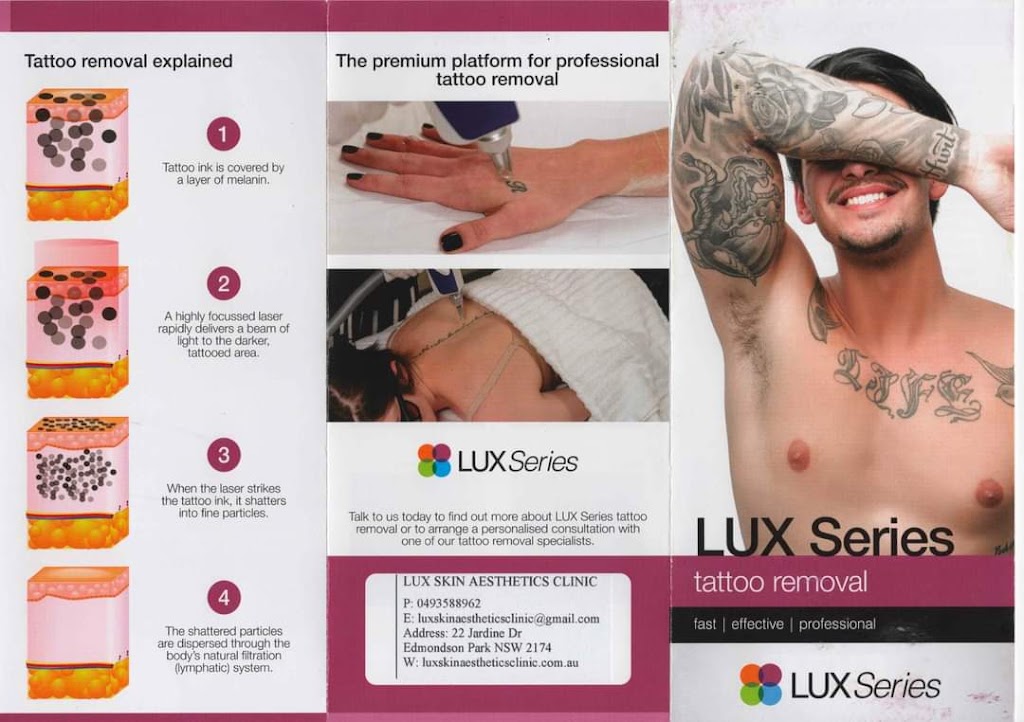 Lux Skin Aesthetics Clinic | 22 Jardine Dr, Edmondson Park NSW 2174, Australia | Phone: 0493 588 962