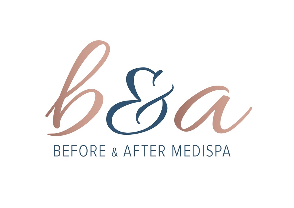 Before and After Medispa | 5/1 Orion St, Balwyn North VIC 3104, Australia | Phone: 0488 030 544