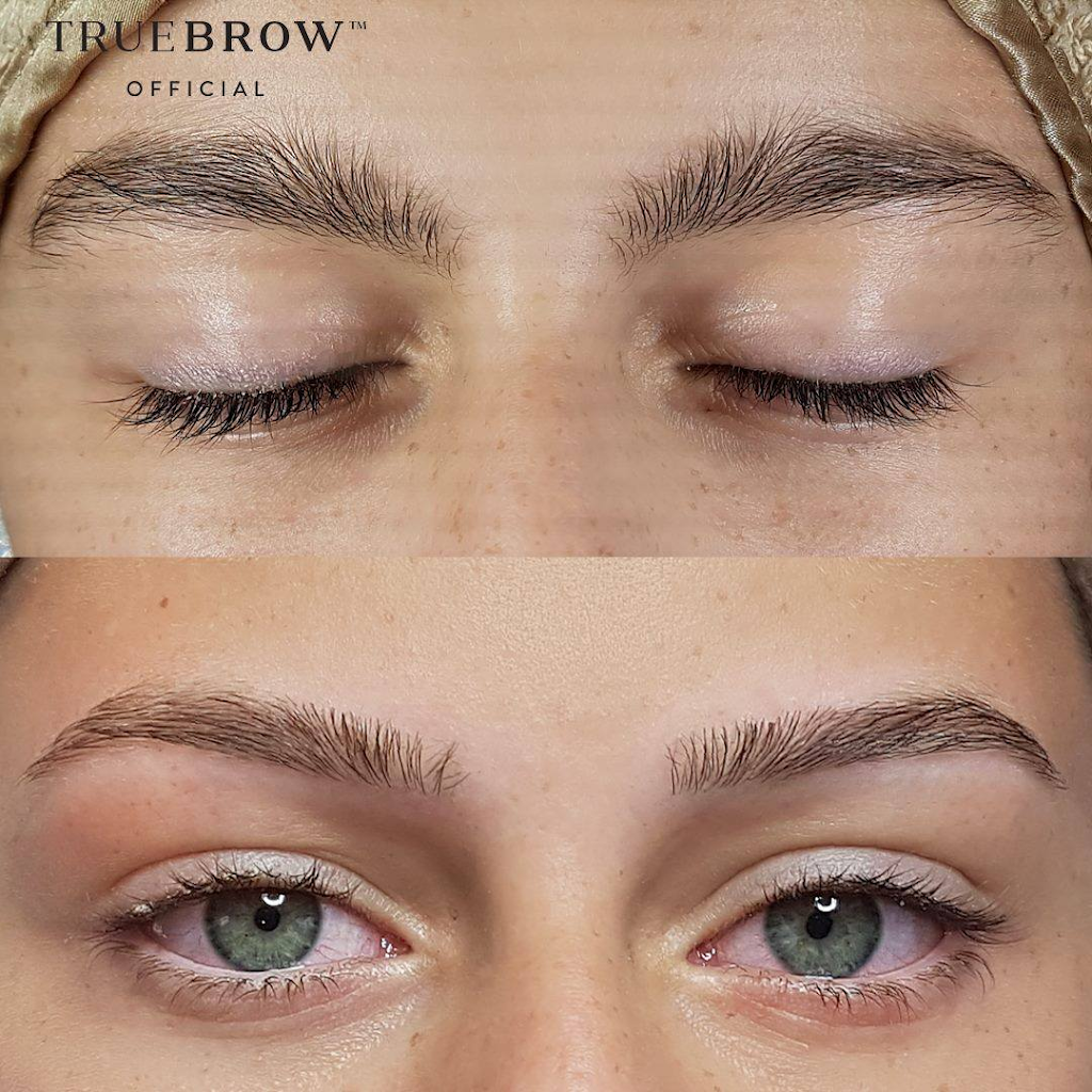 All Over Beauty Clinic- Advanced Brow Specialist and Skin Soluti | 1244 Marmion Ave, Currambine WA 6028, Australia | Phone: (08) 6209 6782