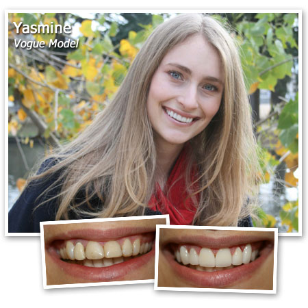 GlamSmile - Dentist WA | Unit 1 2/2 Queensgate Dr, Canning Vale WA 6155, Australia | Phone: 1300 452 676