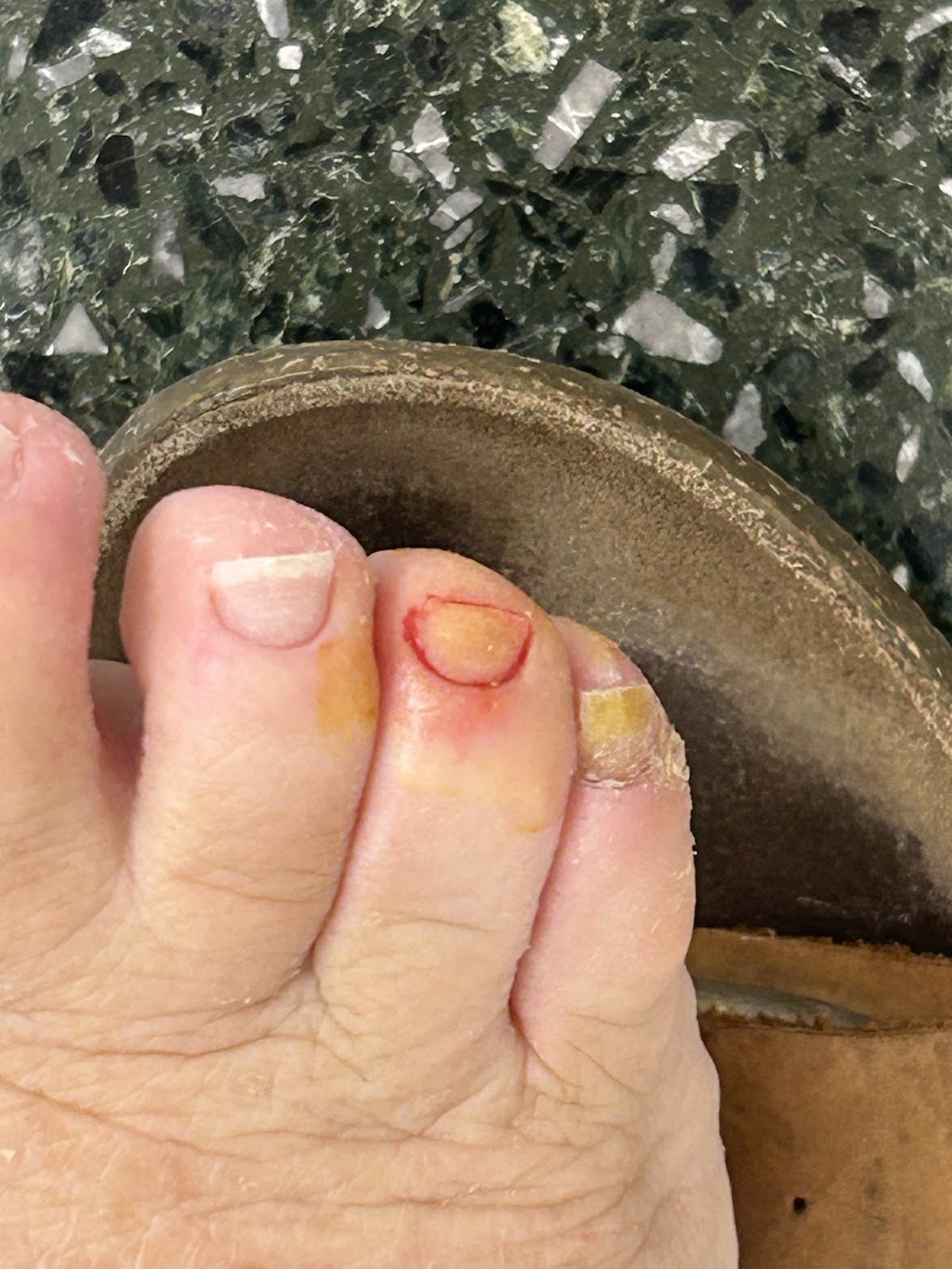 Eternal Nails Erina | Shop T99/419 Terrigal Dr, Erina NSW 2250, Australia | Phone: 0457 328 539