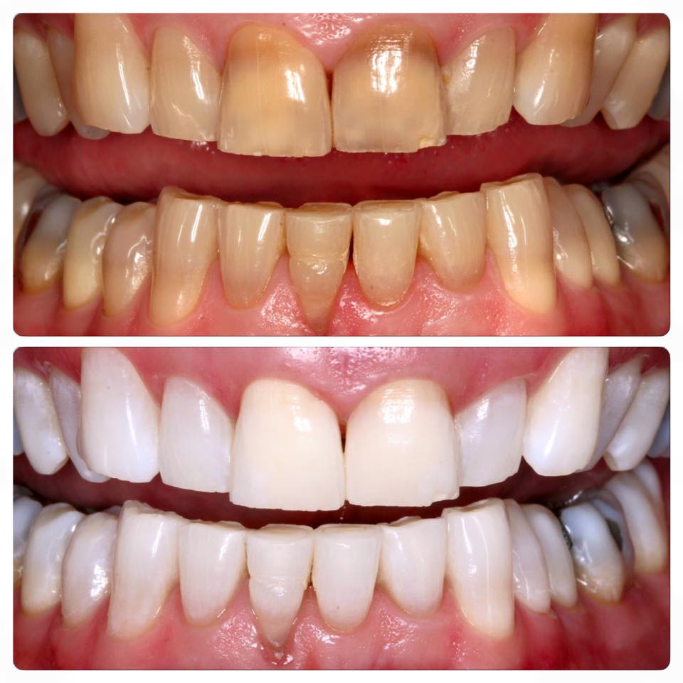 Wangaratta Dental Clinic-Vei Nee Phoon DR | dentist | 38 Reid St, Wangaratta VIC 3677, Australia | 0357213763 OR +61 3 5721 3763