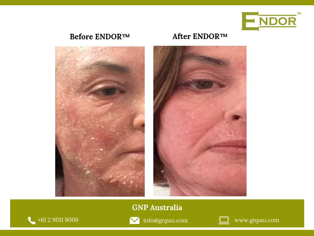 GNP Australia Pty Ltd | health | 28/30 Harris Rd, Dural NSW 2158, Australia | 0290118006 OR +61 2 9011 8006