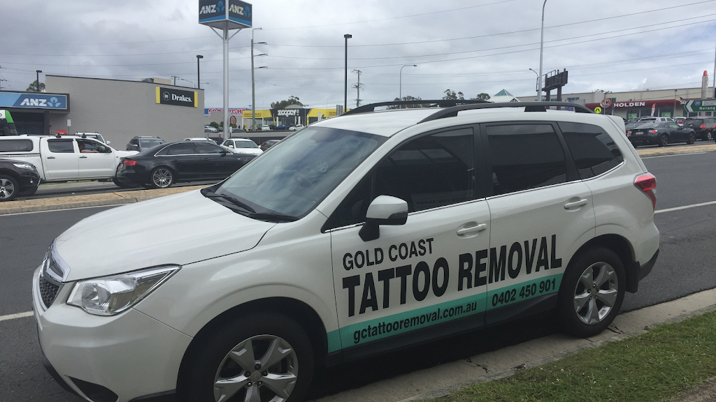 Gold Coast Tattoo Removal | 59 Church St, Boonah QLD 4310, Australia | Phone: 0402 450 901