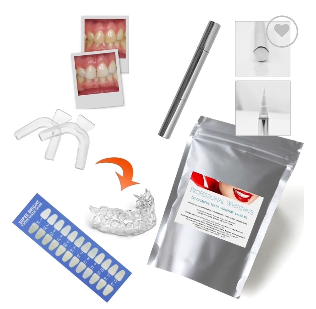 Exotic Touch teeth whitening | Centenary Court, Warner QLD 4500, Australia | Phone: 0499 380 644