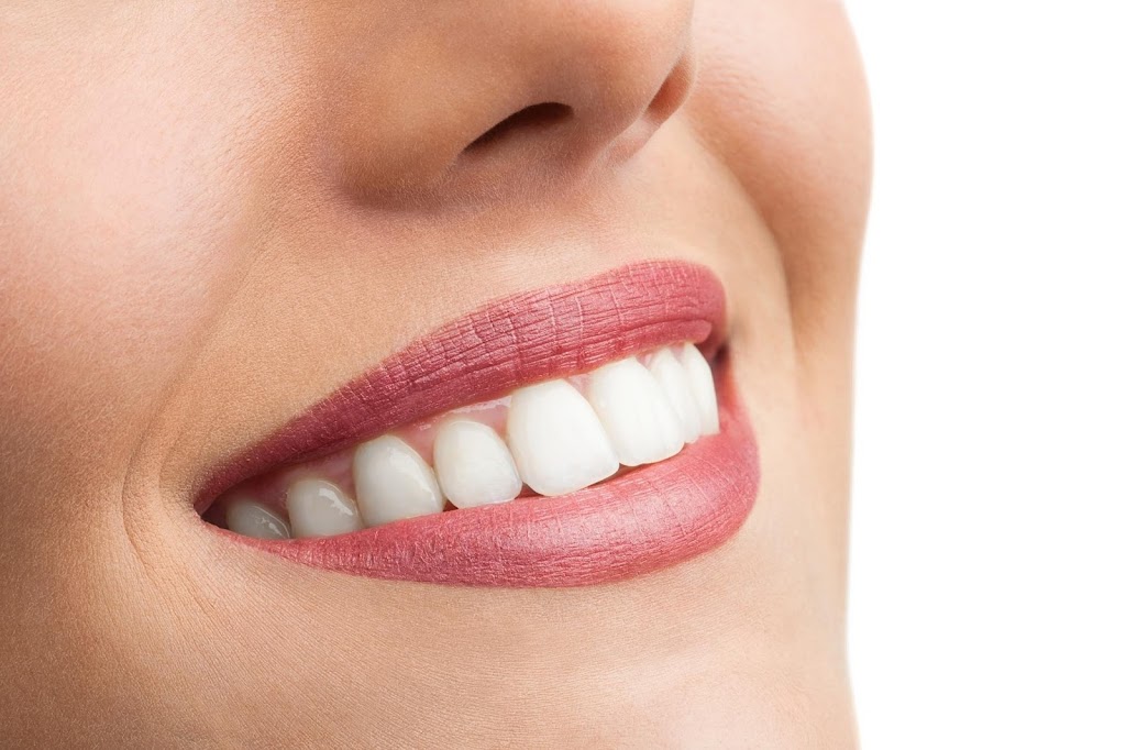Keilor-East Dental Smiles | dentist | 42 Wingara Ave, Keilor East VIC 3033, Australia | 0370380612 OR +61 3 7038 0612