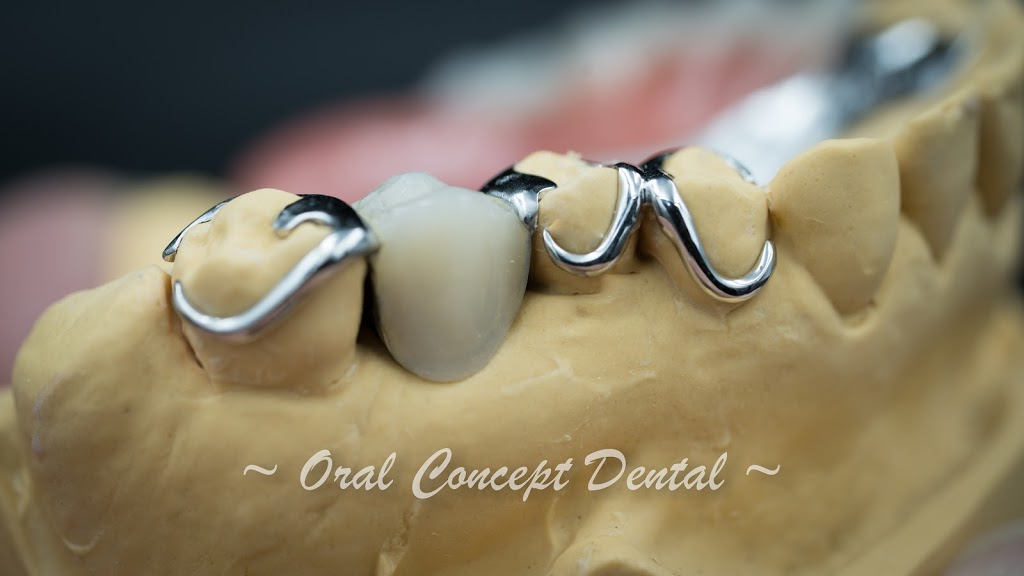 Oral Concept Dental Laboratory | dentist | 25 Whiteside St, Cloverdale WA 6105, Australia | 0892774202 OR +61 8 9277 4202