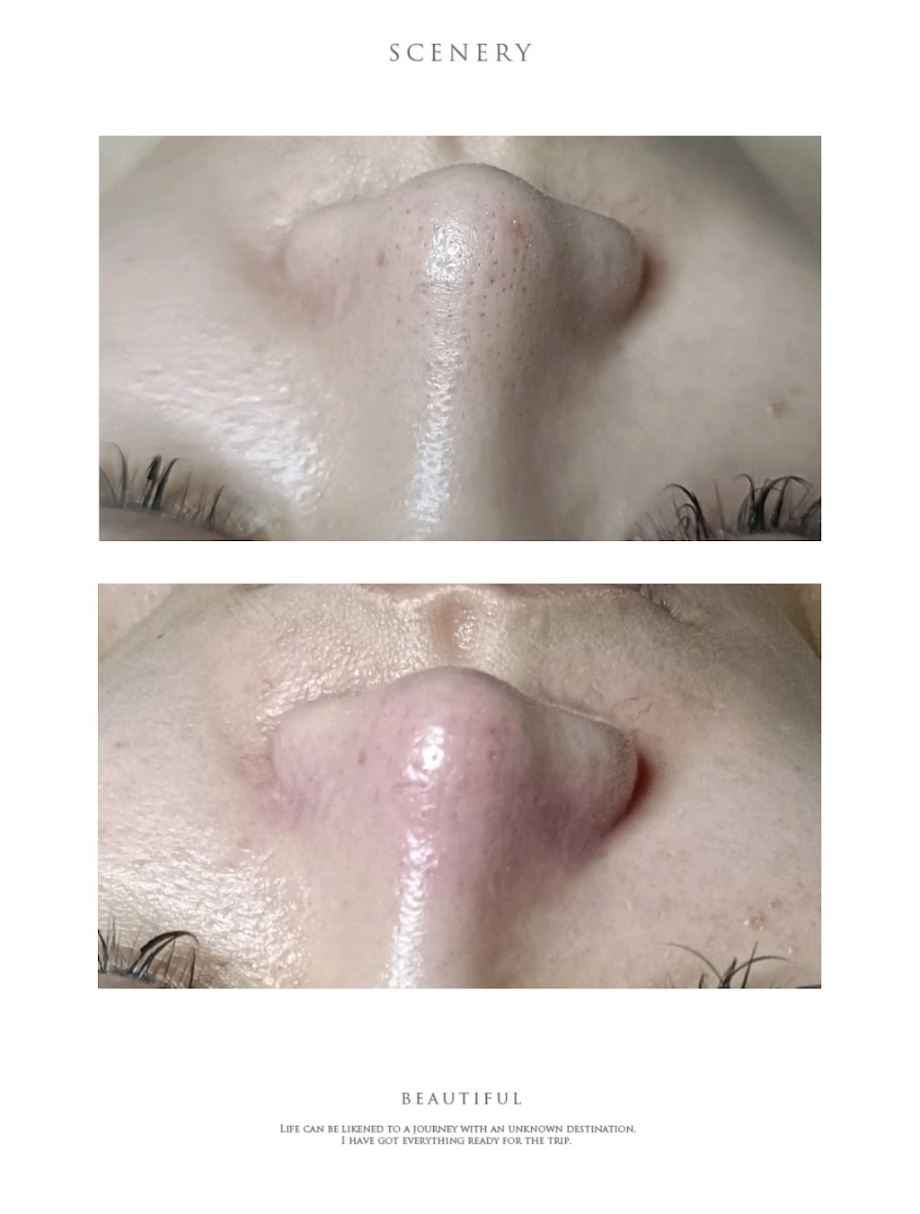 Skin Care & Massage （SHIVOL BIO THERAPEUTIC） 希婭經絡按摩&肌膚護理 | 18 Violet Pl, Calamvale QLD 4116, Australia | Phone: 0401 519 399