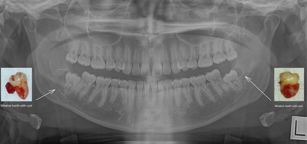 Rien Dental | dentist | 30 Balcombe Rd, Mentone VIC 3194, Australia | 0395831654 OR +61 3 9583 1654