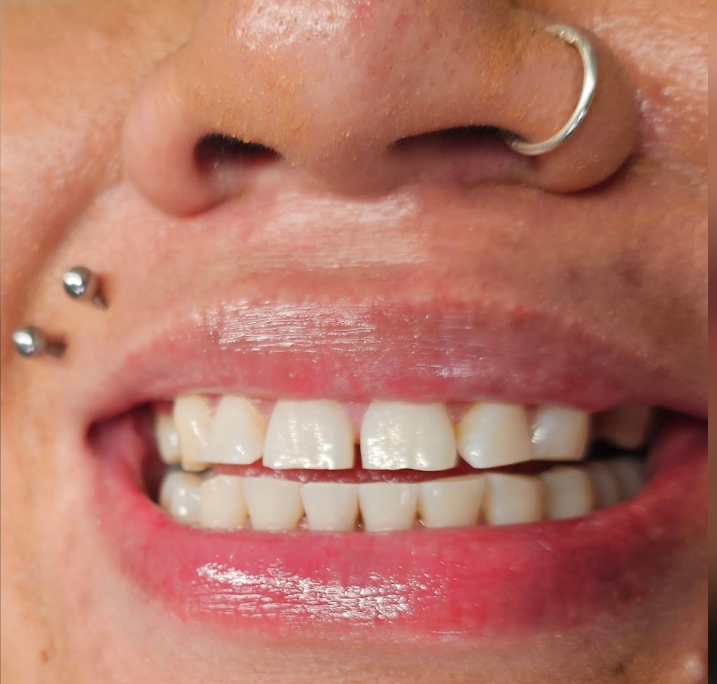 Hibiscus Teeth Whitening | S, 7 Leopard St, Silverdale NSW 2752, Australia | Phone: 0416 817 753