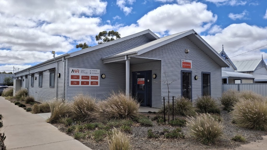 Broken Hill Radiology | 304 Sulphide St, Broken Hill NSW 2880, Australia | Phone: (08) 8088 5958