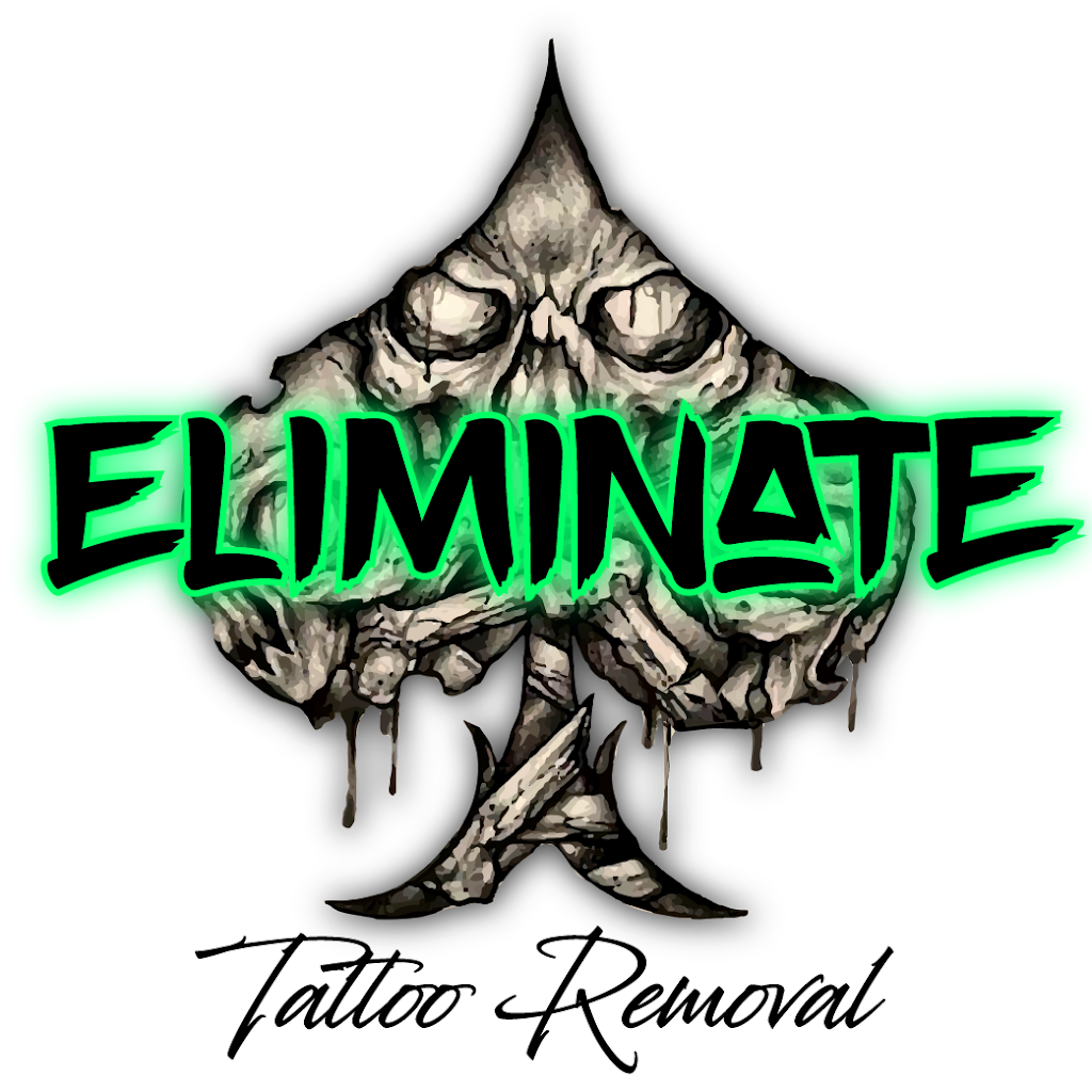 Eliminate Tattoo Removal | 408 Maitland Rd, Mayfield NSW 2304, Australia | Phone: 0403 700 146