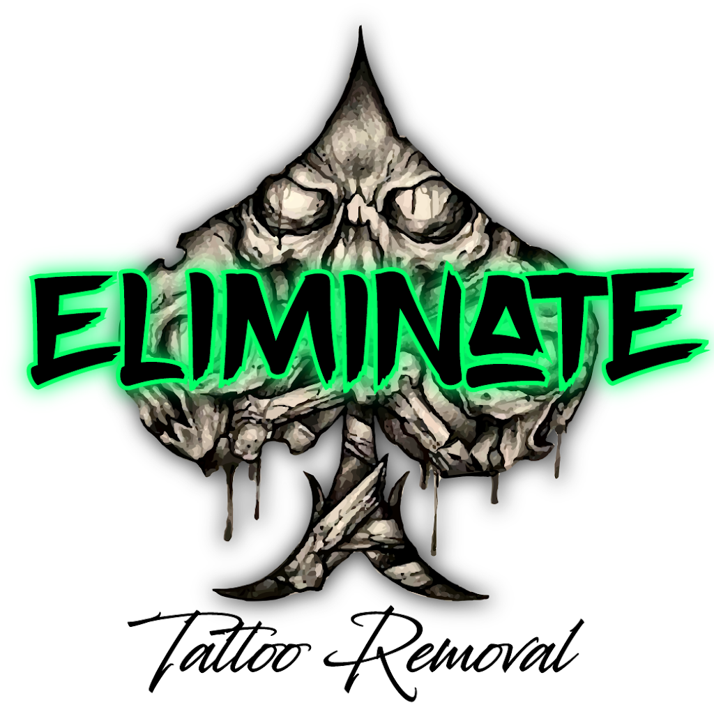 Eliminate Tattoo Removal | hair care | 408 Maitland Rd, Mayfield NSW 2304, Australia | 0403700146 OR +61 403 700 146