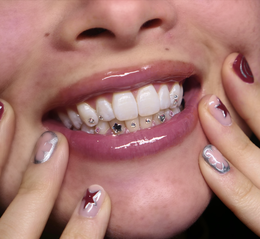 The Gemist Hub | Tooth Gems Sydney | Teeth Whitening Sydney | Vale St, Canley Vale NSW 2166, Australia | Phone: 0416 169 211