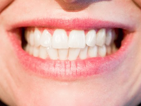 Bright Smiles Dental Surgery | dentist | 53 Heath St, Wagga Wagga NSW 2650, Australia | 0269254536 OR +61 2 6925 4536