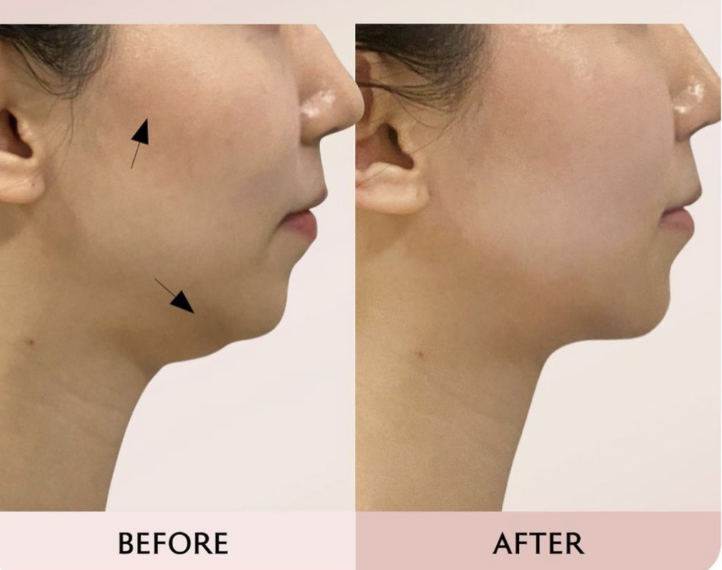 PLUS SKIN & BODY | 32 Bladensburg Dr, Waterford QLD 4133, Australia | Phone: 0431 895 633