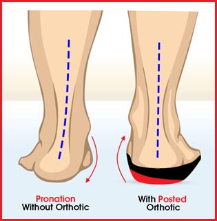 Your Foot And Ankle Clinic | 71 Flemington Pkwy, Box Hill NSW 2765, Australia | Phone: (02) 8632 1014