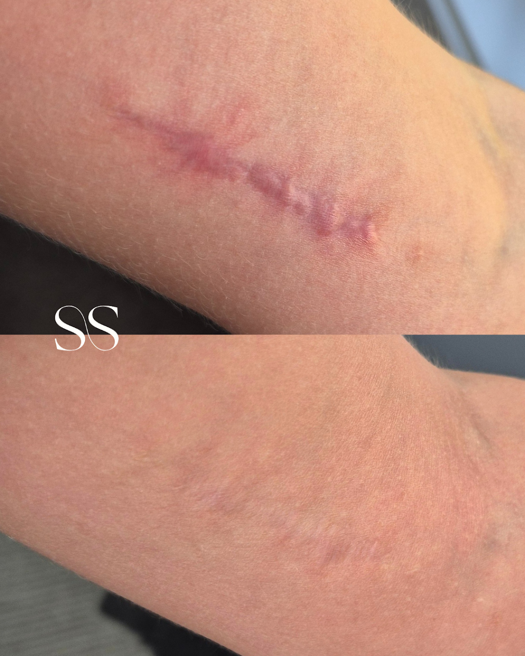 Second Skin By Lauren | 5/141 Maudsland Rd, Oxenford QLD 4210, Australia | Phone: 0480 735 455
