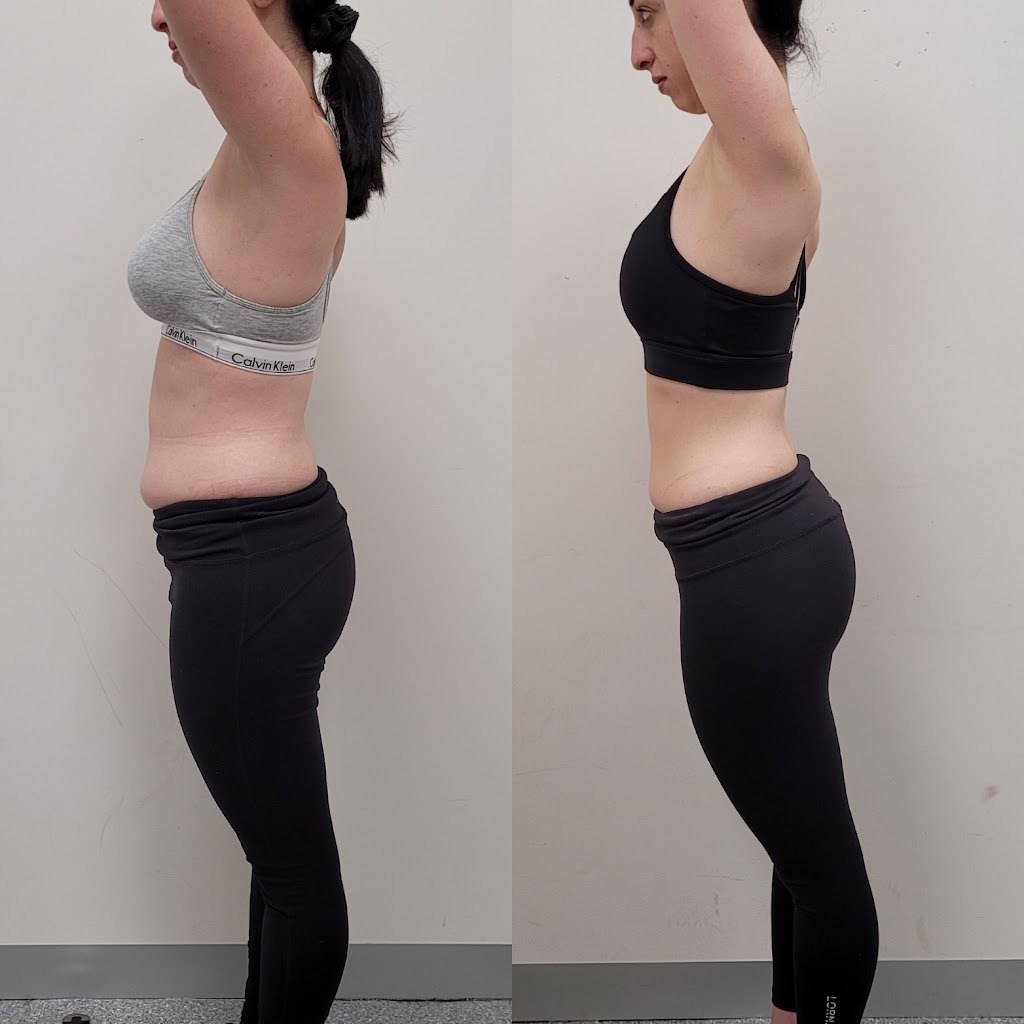 Bell Health and Fitness | Unit 3/573 Burwood Hwy, Knoxfield VIC 3180, Australia | Phone: 0405 606 716