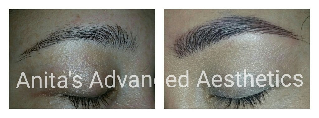 Anitas Advanced Aesthetics Beauty Salon | hair care | 15 MacLeay St, Murrumba Downs QLD 4503, Australia | 0734916655 OR +61 7 3491 6655