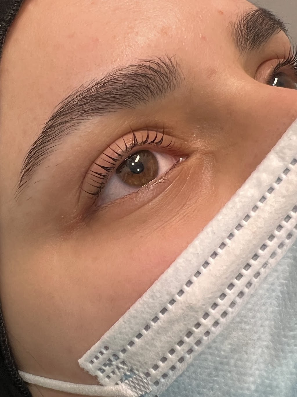 Laser By Zara | 1 Inverness Cct, Cecil Hills NSW 2171, Australia | Phone: 0420 770 846