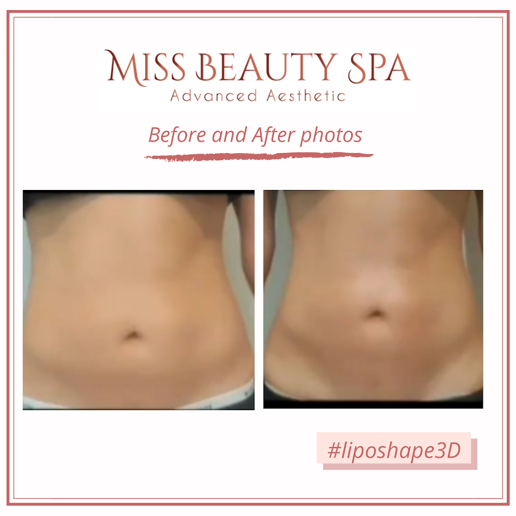 Miss Beauty Spa | health | 2 Taringa Ave, Kellyville NSW 2155, Australia