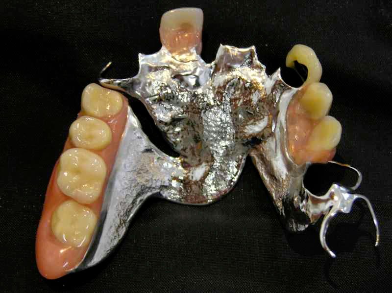 Noble Denture Design | Shop 30/1 Mudgeeraba Rd, Worongary QLD 4213, Australia | Phone: (07) 5525 2899