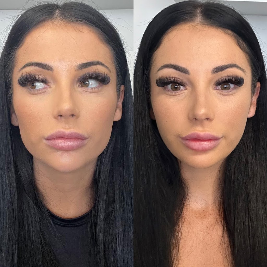 Phoenix Aesthetics Clinic | 30 Elizabeth Bay Dr, Lake Munmorah NSW 2259, Australia | Phone: 0448 784 066