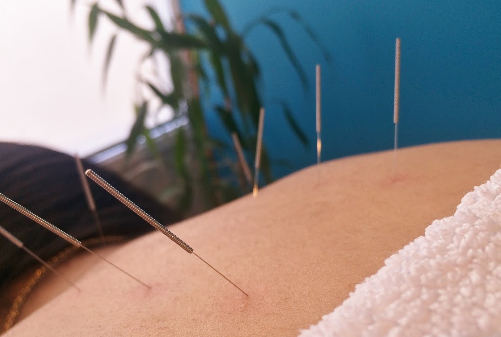 To the Point Health - Hazelbrook | 34 Luchetti Ave, Hazelbrook NSW 2779, Australia | Phone: (02) 4758 9275