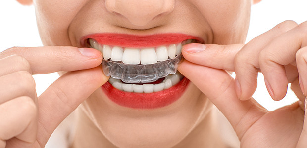 Modern Orthodontics | dentist | 1 Leonard St, Burwood VIC 3125, Australia | 1300367678 OR +61 1300 367 678