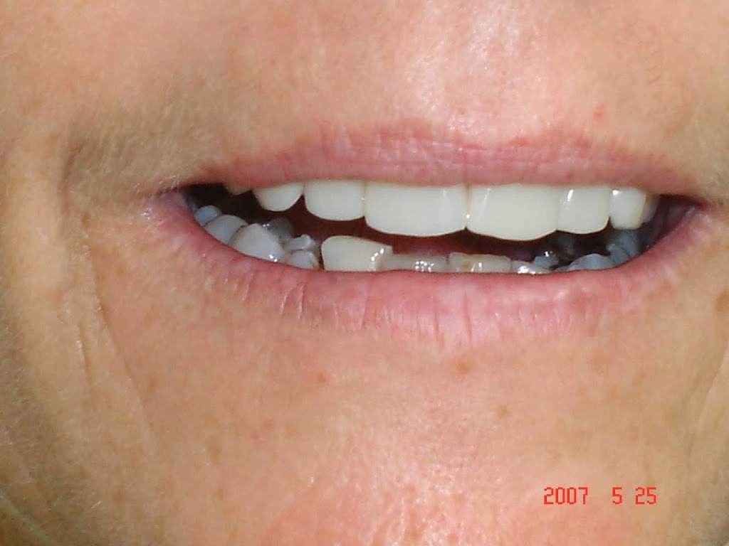 Robert Collins Dental Prosthetist | dentist | 80 Nebo Rd, West Mackay QLD 4740, Australia | 0749577144 OR +61 7 4957 7144
